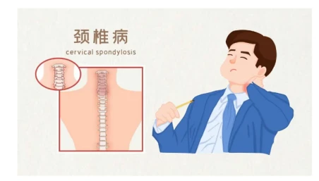 เกี่ยวกับการนอนไม่หลับ? คุณได้พิจารณาถึงสาเหตุของกระดูกสันหลังส่วนคอแล้วหรือยัง?