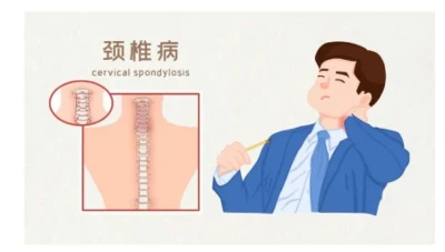 เกี่ยวกับการนอนไม่หลับ? คุณได้พิจารณาถึงสาเหตุของกระดูกสันหลังส่วนคอแล้วหรือยัง?